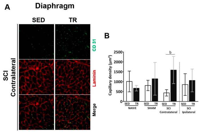 SCI Contralateral ENDICAP Jesus et Al