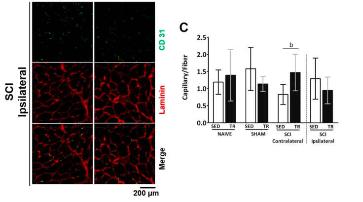 SCI Ipsilateral ENDICAP Jesus et Al