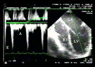 figure3-pales-coupes03